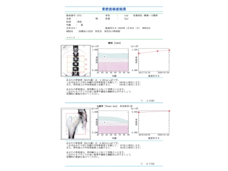 骨密度検査結果