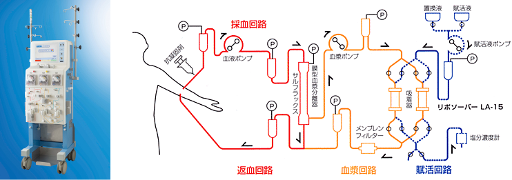 LDL吸着療法